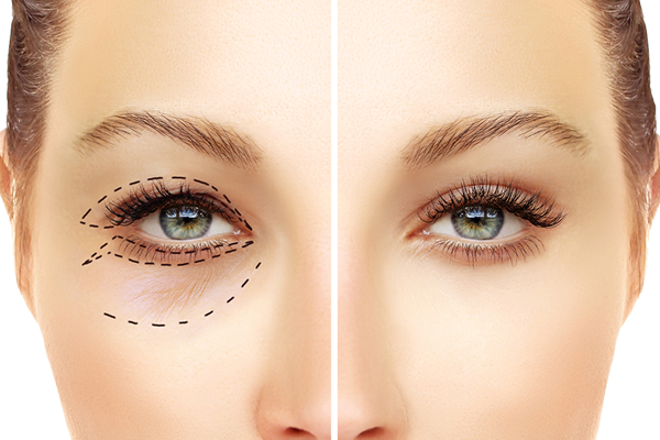 Revive Bharuch Laser Centre