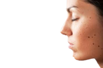 Revive Bharuch Laser Centre