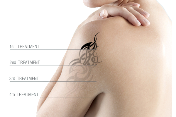 Revive Bharuch Laser Centre